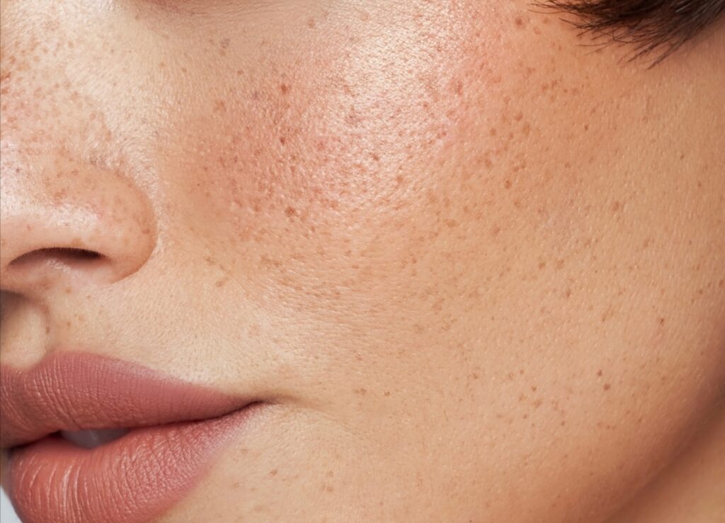 5_steps_summer_Skincare_dalu_natural_skincare