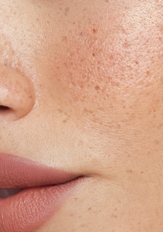 Skin Summer Hydration